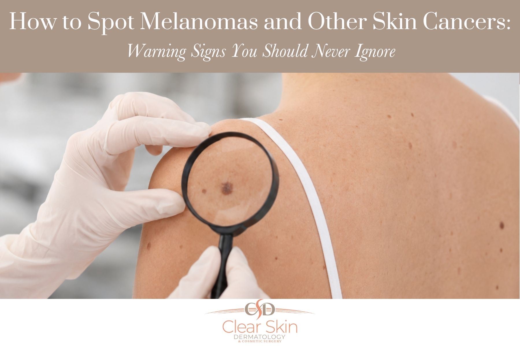 How to Spot Melanomas and Other Skin Cancers Warning Signs You Should Never Ignore