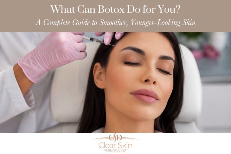 What Can Botox Do for You? A Complete Guide to Smoother, Younger-Looking Skin